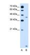 Solute Carrier Family 46 Member 3 antibody, NBP1-80531, Novus Biologicals, Western Blot image 