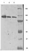 Folate Hydrolase 1 antibody, GTX80151, GeneTex, Western Blot image 