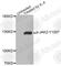 Janus Kinase 2 antibody, AP0594, ABclonal Technology, Western Blot image 