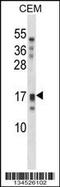Kallikrein Related Peptidase 15 antibody, 58-018, ProSci, Western Blot image 