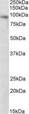 Deltex E3 Ubiquitin Ligase 3 antibody, EB09706, Everest Biotech, Western Blot image 