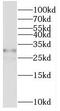 Phosphatidylinositol-4,5-Bisphosphate 4-Phosphatase 1 antibody, FNab08786, FineTest, Western Blot image 