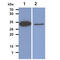 Thiopurine S-Methyltransferase antibody, GTX57582, GeneTex, Western Blot image 