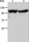 Actinin Alpha 3 (Gene/Pseudogene) antibody, LS-C401167, Lifespan Biosciences, Western Blot image 