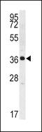 Kallikrein Related Peptidase 2 antibody, 62-244, ProSci, Western Blot image 