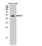 Armadillo Repeat Containing X-Linked 1 antibody, A09670, Boster Biological Technology, Western Blot image 