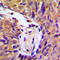 Component Of Inhibitor Of Nuclear Factor Kappa B Kinase Complex antibody, LS-C352002, Lifespan Biosciences, Immunohistochemistry paraffin image 