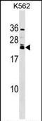 Heart- and neural crest derivatives-expressed protein 2 antibody, PA5-35186, Invitrogen Antibodies, Western Blot image 