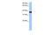 Germ Cell Associated 1 antibody, GTX45446, GeneTex, Western Blot image 