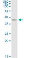 Serum/Glucocorticoid Regulated Kinase 2 antibody, MA5-20931, Invitrogen Antibodies, Immunoprecipitation image 