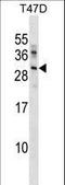 Ubiquitin Conjugating Enzyme E2 R2 antibody, LS-C157010, Lifespan Biosciences, Western Blot image 