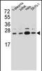 Signal Sequence Receptor Subunit 2 antibody, PA5-71791, Invitrogen Antibodies, Western Blot image 