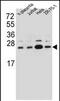 Signal Sequence Receptor Subunit 2 antibody, PA5-71791, Invitrogen Antibodies, Western Blot image 