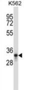Pancreas Associated Transcription Factor 1a antibody, abx027663, Abbexa, Western Blot image 