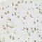 Transglutaminase 2 antibody, LS-C331183, Lifespan Biosciences, Immunohistochemistry frozen image 