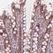 Zinc Finger Protein 471 antibody, PA5-64281, Invitrogen Antibodies, Immunohistochemistry paraffin image 