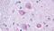 Cholinergic Receptor Muscarinic 4 antibody, PA5-33433, Invitrogen Antibodies, Immunohistochemistry frozen image 