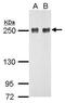 Roundabout Guidance Receptor 1 antibody, PA5-34822, Invitrogen Antibodies, Western Blot image 