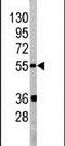 PIST antibody, PA5-14115, Invitrogen Antibodies, Western Blot image 