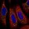 Small Integral Membrane Protein 5 antibody, HPA065332, Atlas Antibodies, Immunofluorescence image 