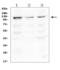 HECT And RLD Domain Containing E3 Ubiquitin Protein Ligase 5 antibody, A05285-2, Boster Biological Technology, Western Blot image 