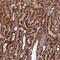 Coiled-Coil Domain Containing 8 antibody, NBP1-85085, Novus Biologicals, Immunohistochemistry paraffin image 