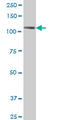 PTK7 antibody, LS-C198030, Lifespan Biosciences, Western Blot image 