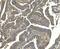 Eukaryotic Translation Elongation Factor 2 antibody, M00830-2, Boster Biological Technology, Immunohistochemistry paraffin image 