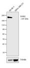 ERBB2 antibody, MA5-13102, Invitrogen Antibodies, Western Blot image 