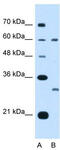 AML1-regulated transmembrane protein 1 antibody, TA339019, Origene, Western Blot image 