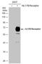 Interleukin 17 Receptor B antibody, GTX127368, GeneTex, Western Blot image 