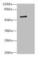 5-aminolevulinate synthase, erythroid-specific, mitochondrial antibody, orb21226, Biorbyt, Western Blot image 