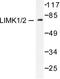 LIMK antibody, LS-C176106, Lifespan Biosciences, Western Blot image 