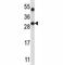 Sirtuin 5 antibody, F43966-0.4ML, NSJ Bioreagents, Western Blot image 