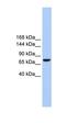 Transmembrane Channel Like 2 antibody, orb325569, Biorbyt, Western Blot image 