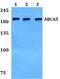 ATP Binding Cassette Subfamily A Member 5 antibody, PA5-37131, Invitrogen Antibodies, Western Blot image 