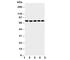 Arachidonate 5-Lipoxygenase antibody, R30728, NSJ Bioreagents, Western Blot image 