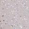 Acid Phosphatase 7, Tartrate Resistant (Putative) antibody, HPA042613, Atlas Antibodies, Immunohistochemistry paraffin image 