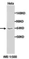 Serine/Threonine Kinase 17a antibody, orb77178, Biorbyt, Western Blot image 