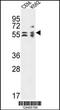 Tubulin Folding Cofactor E antibody, 64-058, ProSci, Western Blot image 