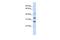 Centromere Protein H antibody, GTX44860, GeneTex, Western Blot image 