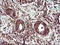 Thioredoxin Related Transmembrane Protein 1 antibody, M07462, Boster Biological Technology, Immunohistochemistry paraffin image 