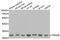Tyrosine 3-Monooxygenase/Tryptophan 5-Monooxygenase Activation Protein Beta antibody, STJ26141, St John