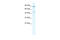 Potassium Voltage-Gated Channel Subfamily Q Member 2 antibody, 28-293, ProSci, Western Blot image 