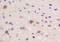 Coatomer Protein Complex Subunit Gamma 2 antibody, orb182666, Biorbyt, Immunohistochemistry paraffin image 