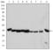 Cyclin Dependent Kinase 1 antibody, STJ97946, St John