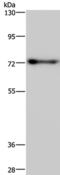 POZ/BTB And AT Hook Containing Zinc Finger 1 antibody, PA5-50721, Invitrogen Antibodies, Western Blot image 