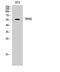 Lysine Acetyltransferase 5 antibody, A01393, Boster Biological Technology, Western Blot image 