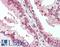 Plexin B1 antibody, LS-B15439, Lifespan Biosciences, Immunohistochemistry paraffin image 