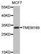 Transmembrane Protein 189 antibody, A8380, ABclonal Technology, Western Blot image 